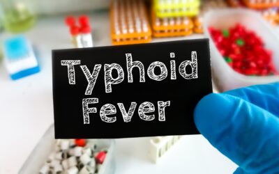 Beware of typhoid fever: Symptoms often mistaken for malaria, dengue by Dr. Ajua Nkeng